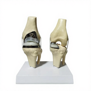 Detachable Knee Joint Implant <b>Model</b> Double Type PVC Anatomical Teaching <b>Model</b> Manikin by Dentavex - Product Image 4