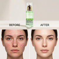 Sérum à 10% d'acide azélaïque avec acide hyaluronique pour soulager les rougeurs, resserrer les pores, traiter l'acné, soin de la peau du visage