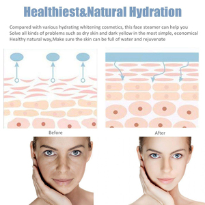 Vaporizador Facial Iónico Inteligente <span class=keywords><strong>para</strong></span> <span class=keywords><strong>el</strong></span> Cuidado Personal, Sauna de Belleza con Calentamiento PTC, Vaporizador Facial con Ozono <span class=keywords><strong>para</strong></span> Uso Doméstico - Product Image 5