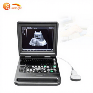 Máquina de Ultrasonido Portátil para <span class=keywords><strong>Embarazo</strong></span> Humano de 12.1 Pulgadas, Imágenes Claras a Color - Product Image 1