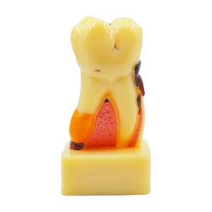 Gelsonlab HSDT-C17 4 Vezes a doença periodontal Modelo Dos Dentes - Product Image 2