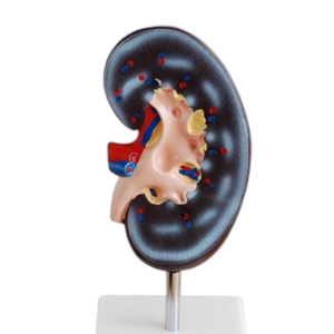 แบบจำลองกายวิภาคไต ตับ ต่อมลูกหมาก ลำไส้ส่วนต้นลำไส้ใหญ่ ADA Medical Science (ADA-310-2/ADA-311) สำหรับการเรียนการสอนกายวิภาคศาสตร์ - Product Image 5