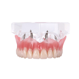 Modelo de cirugía dental y oral para nuevos productos de ciencia médica de implantación y Prostodoncia - Product Image 4