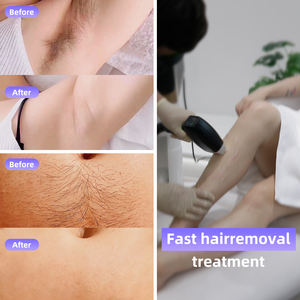 Máquina de Depilação a <span class=keywords><strong>Laser</strong></span> de Diodo OEM ODM Marca 2 Alças 3 Ondas Gelo Platina Titânio 755nm 808nm 1064nm 755 810 1064 - Product Image 6