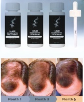 Huile capillaire en gros OEM pour usines : Sérum de croissance naturel à base de plantes avec applicateur roll-on, à l'huile de coco, pour réparer, épaissir et volumiser les cheveux