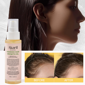 Huile de croissance capillaire Akaril Voodoo 100% naturelle à base d'extraits de plantes favorise la repousse des cheveux prévient les pellicules et les démangeaisons du cuir chevelu hydrate les cheveux - Product Image 4