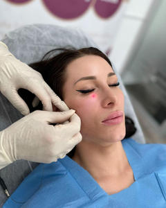 Macchina per Terapia <span class=keywords><strong>Laser</strong></span> Minimamente Invasiva per Lifting Facciale e Rimozione del Grasso, <span class=keywords><strong>Laser</strong></span> a Doppia Lunghezza d'Onda 980nm 1470nm - Product Image 3