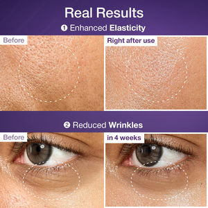 NAD 바이오 에센스 펩타이드 세럼 인스턴트 페이스 리프트 바디 글로스 트리트먼트 주름 둔한 피부 랩 포뮬러 OEM/ODM - Product Image 2