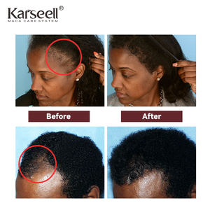 Nouveauté : Ensemble shampooing et revitalisant Maca Power <span class=keywords><strong>Esssence</strong></span> anti-chute de cheveux, soin capillaire, stimulant la pousse des cheveux pour femmes et hommes - Product Image 6