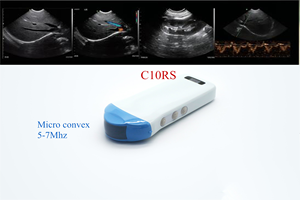 Konted Mdr Hoge Kwaliteit Werken Aan Mobiele Telefoon Mirco-Convexe Draadloze Sonde Echografie - Product Image 5