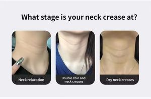 Recarregável V-Shape Face <span class=keywords><strong>Massager</strong></span> Anti-Aging Slimming Massage Tool Mesotherapy Lifting Mini Face Lifter Machine Massage - Product Image 5