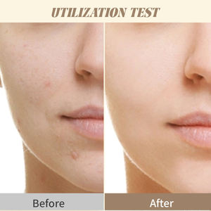 Almohadillas de máscara facial de poros ultrafinas de estilo coreano con <span class=keywords><strong>pinzas</strong></span> 2% ácido salicílico BHA y complejo de fermento probiótico - Product Image 4