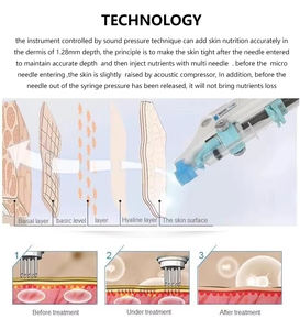 Machine de mésothérapie à injection de méso-pistolet pour le blanchiment et le rajeunissement de la peau du visage ABS 2026, pour l'anti-âge et l'utilisation à domicile - Product Image 4