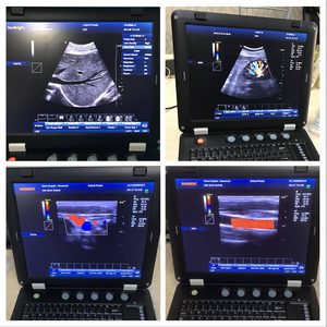 Ecógrafo Doppler Color Portátil para Uso Humano, Ginecología y Cardiovascular SUN-906A - Product Image 1