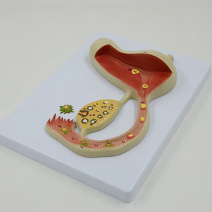 Modelo de enseñanza del desarrollo del óvulo fertilizado reproductivo femenino modelo útero-ovárico de órganos reproductivos femeninos - Product Image 4
