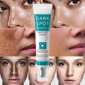 Crema para el Cuidado de la Piel OEM/ODM para Eliminar Manchas Oscuras, Pecas, <span class=keywords><strong>Melasma</strong></span>, Acné, Blanqueadora, Contiene Arbutina, Ceramida y Ácido Kójico - Product Image 2