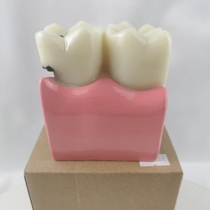 Modèle de dent à carie M4021 non amovible pour la formation et la pratique dentaire, couleur blanche, 233g, kit individuel - Product Image 1