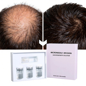 Suero Capilar Orgánico Herbal con <span class=keywords><strong>Biotina</strong></span> de Marca Privada para el Crecimiento del Cabello con Tratamiento de Romero para el Cuero Cabelludo, Anticaída y Suavizante - Product Image 1