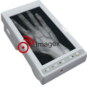 Desain baru pencari pembuluh darah inframerah penampil Nadi LCD pencari Nadi untuk ruangan darurat dan klinik dokter hewan - Product Image 1