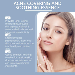 Sérum apaisant pour l'acné HOYGI, hydratant et nourrissant pour la peau du visage, soin doux pour les cicatrices d'acné et les imperfections cutanées - Product Image 4