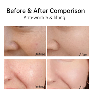 Siero Idratante Triplo Effetto P.C.P con Pro-Xylane, Acido Ialuronico e Peptidi, Siero Viso Anti-Età e Rassodante OEM/ODM - Product Image 5