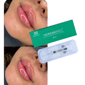 Faible MOQ, <span class=keywords><strong>Prix</strong></span> Usine France, Acide Hyaluronique Pur en Vrac pour Anti-rides, Anti-âge et Lissage de la Peau, Remplisseur de Couleur pour les Lèvres - Product Image 1
