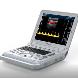 CONTEC CMS1700B ultrasonic diagnostic systems ultrasonography scanner portable ultrasound in 3d and 4d