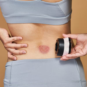 Kit de ventouses personnalisé avec <span class=keywords><strong>marque</strong></span> personnalisée, masseur à ventouses sous vide 3-en-1 et brevet de conception pour salons de beauté - Product Image 1