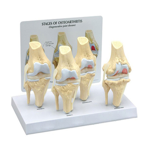 Modelo de Rodilla Humana con Simulación de PVC para Osteoartritis, Modelo Anatómico de <span class=keywords><strong>Esqueleto</strong></span> Médico - Product Image 6