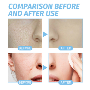 Suero Original de Fábrica en Stock ODM OEM 30ml Antiarrugas Reparador de Barrera Cutánea Reafirmante con Péptido de Cobre GHK-Cu para el Rostro - Product Image 3