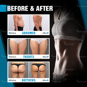 Perfectlaser - Máquina Profesional de Escultura Corporal EMS 2 en 1 con Radiofrecuencia para Desarrollo Muscular y Reafirmación de la Piel - Product Image 6