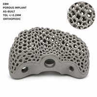 Implante Ortopédico Poroso de Ti-6Al-4V ELI Impreso en 3D con Estructura de Rejilla Mediada por Fusión por Haz de Electrones, Dispositivo Médico Personalizado OEM