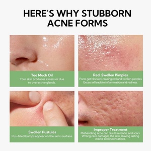 Suero Antiacné y Antiedad, Suero Blanqueador Fuerte Antiarrugas 30ml para Venta al Por Mayor Personalizado - Product Image 3