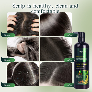 Bajo MOQ Productos para el cabello Fabricante mayorista de China Hidratante Reparación DE DAÑOS Mejor tratamiento Queratina Ginseng Champú para el cabello - Product Image 5