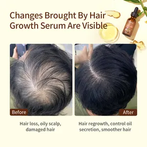 שיער אובדן לצמיחה מחודשת טיפולים מוצרים 7 ימים זנגביל נבטי שמן מהות תיקון להזין ג 'ינג' ר שיער צמיחת סרום