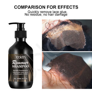 Peluca nutritiva de alta calidad, Etiqueta Privada, pegamento de limpieza profunda, removedor de residuos, champú - Product Image 6