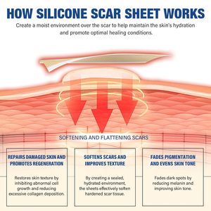 Fita de Silicone Médica Profissional para Cicatrizes, Estrias e Remoção de Protuberâncias, Atacado a Granel - Product Image 3