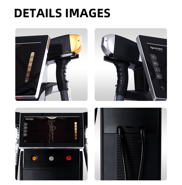 Alma Professional 808mn Diode Laser Ice Titanium Diode Hair Removal Machine
