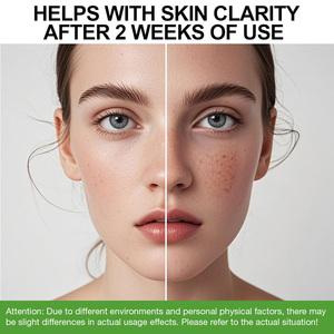 Tự Nhiên Thuần Chay Hàn Quốc Chăm Sóc Da Sản Phẩm Nhạy Cảm Huyết Thanh Hyadrating 10 + Đỏ Nhẹ Nhàng Glass Da Azelaic Axit Huyết Thanh - Product Image 4