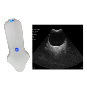 Sonde échographique Doppler USB Wi-Fi CProbe-4M à <span class=keywords><strong>prix</strong></span> <span class=keywords><strong>d</strong></span>'usine, micro-convexe pour échographie Pocus - Product Image 4