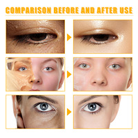OUHOE Huile Décolorante Forte Éclaircissante pour la Peau Corps Visage Dissolvant de Peau Morte Exfoliant Nourrit Blanchissant Jaune Huile de Gommage