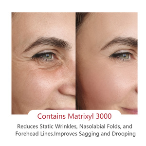 Siero Anti-Età Matrixyl 3000 per Riduzione Rughe, Rassodamento, Rimpolpamento e Riparazione della Pelle con Texture Acquosa ad Assorbimento Rapido - Product Image 4