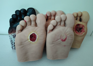 Modèle de pied diabétique en silicone de haute qualité avec ulcères purulents pour l'enseignement infirmier - Product Image 3