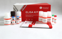 Kit Elisa Solarbio pour Interleukine 21 Humaine IL-21 pour la Recherche Scientifique