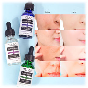 MELAO <span class=keywords><strong>Anti</strong></span>-<span class=keywords><strong>Aging</strong></span> yüz Serum C vitamini A vitamini hyaluronik asit (3x1 oz) serum kitleri özel etiket - Product Image 5