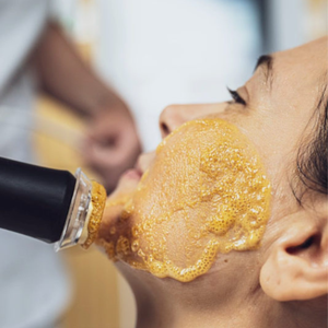 Kit de capsules d'oxygène pour machine faciale à bulles de CO2, consommables, pour oxygénation, détox, hydratation, glamour, équilibre, revitalisation - Product Image 6