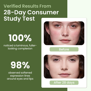 Sérum Rétinol Bio Sérum Anti-âge Visage Acide Hyaluronique <span class=keywords><strong>Aloe</strong></span> <span class=keywords><strong>Vera</strong></span> <span class=keywords><strong>pour</strong></span> Hydrater Réduire <span class=keywords><strong>les</strong></span> <span class=keywords><strong>Rides</strong></span> Sérum Anti-Taches Noires - Product Image 5