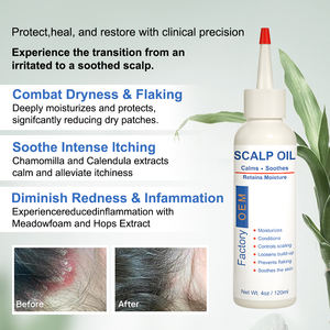 Huile de <span class=keywords><strong>psoriasis</strong></span> et de pellicules de marque privée pour le cuir chevelu huile de massage apaisante squameuse anti-démangeaisons pour le cuir chevelu - Product Image 3