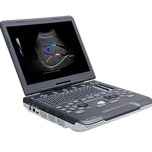 Ecógrafo Veterinario SIUI Apogee 1000 Lite, el Más Vendido, Portátil, con Doppler a Color y Pantalla de 15 Pulgadas - Product Image 1