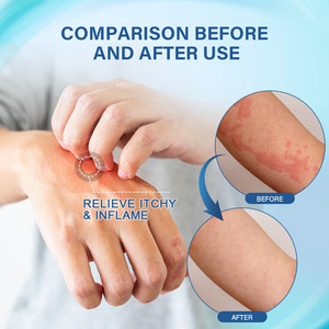 Ungüento Sumifun, Venta Caliente, Refrescante, Antibacteriano, Antiinflamatorio para la Piel, Ungüento para Dermatitis 2024, 20g - Product Image 2